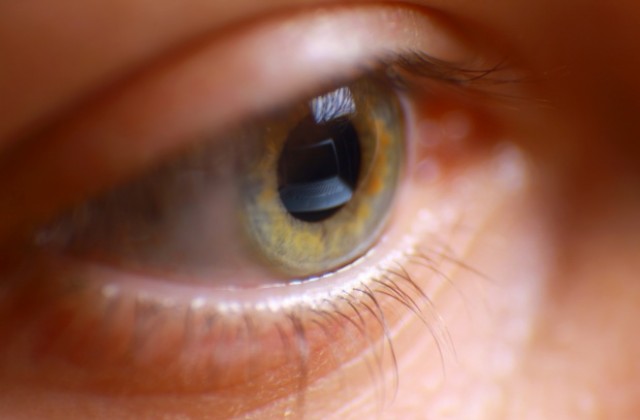 Хирурзи успешно присадиха „бионично око” на 80-годишен пациент