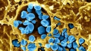 След бруцелозата и болен от туларемия в Кюстендилска област