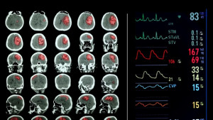 Учени промениха мнението и вярата на хора чрез магнитни импулси