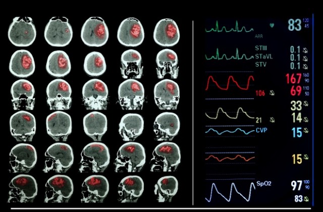 Учени промениха мнението и вярата на хора чрез магнитни импулси