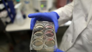 Японски учени атакуват левкемията със стволови клетки