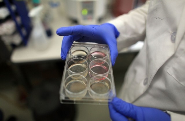 Японски учени атакуват левкемията със стволови клетки