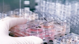 Мобилна лаборатория за безплатно изследване за ХИВ СПИН идва на