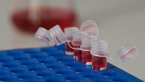 51 от новорегистрираните с ХИВ са инфектирани от хомо или