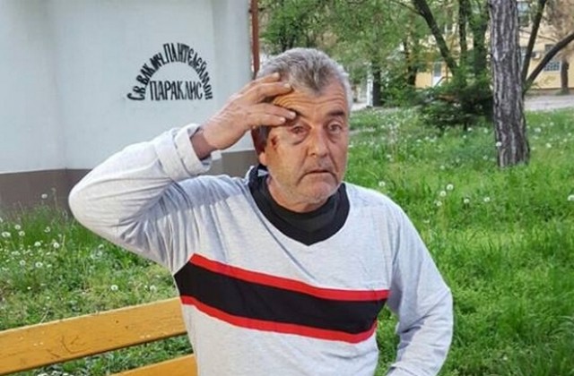 Пребитият на пътя в с. Добрич от курсант в Академията на МВР разказва за побоя (ВИДЕО)