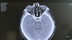 Демонстрират на живо медицинска маса за виртуални дисекции в МУПлевен