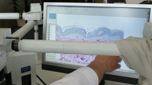 Всяка трета българка страда от миомна болест