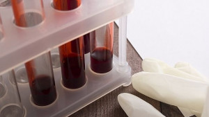 Регистрираха три нови случая на вирусен менингит в Търновско