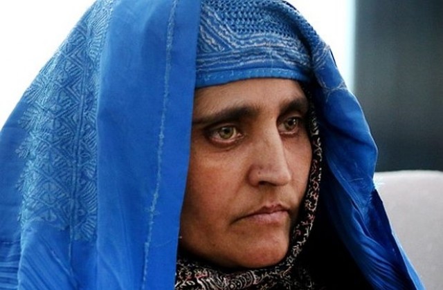 Афганистанската Мона Лиза получи безплатно лечение в Индия