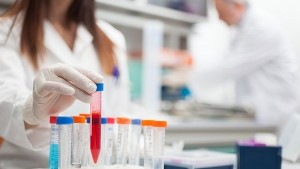 Учени изясниха как са се зародили сложните форми на живот