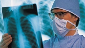  Преглеждат гратис за туберкулоза 