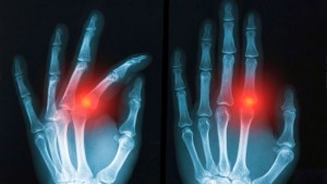 Американец си имплантира безжични чипове за да стане киборг СНИМКИ