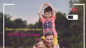 Синдром Даун