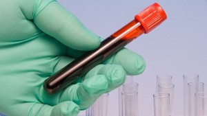 кръв тест кръв кръвна група