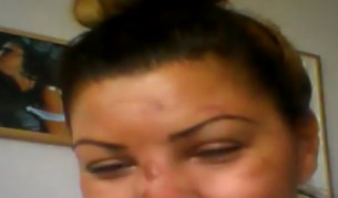 Сани след побоя: Той каза, че българите са цигани