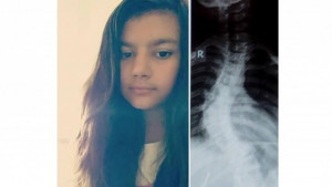 Симона Добрич лечение