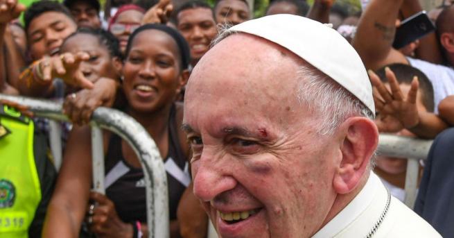 Папа Франциск получи рана на лицето когато папамобилът му се