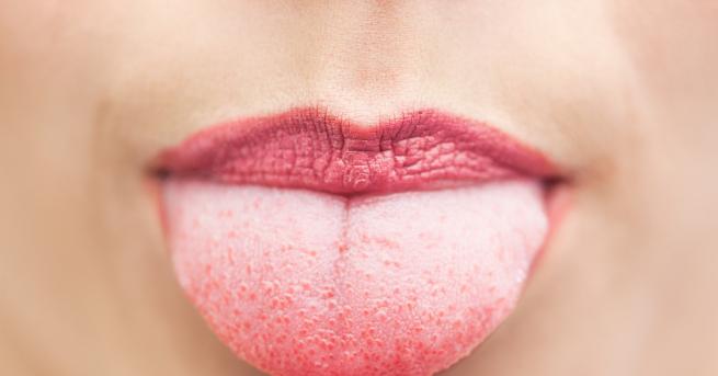 Цветът текстурата и влажността на езика ви могат да бъдат