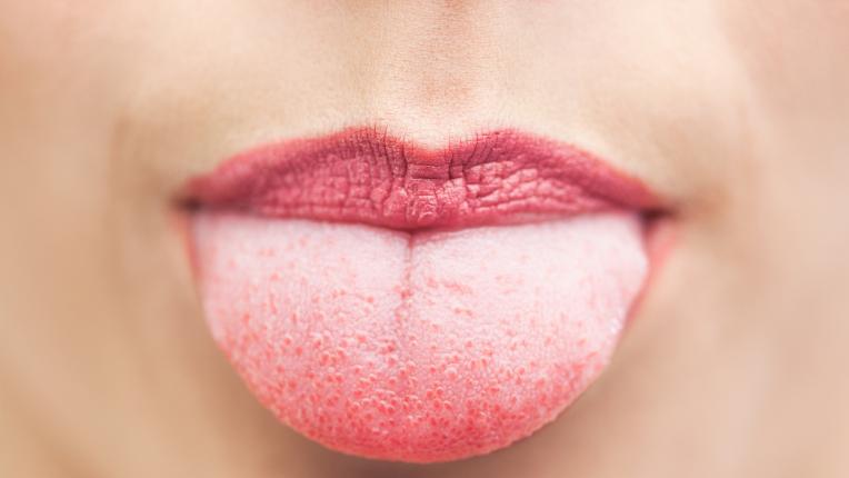 Цветът на езика разкрива здравословното ви състояние
