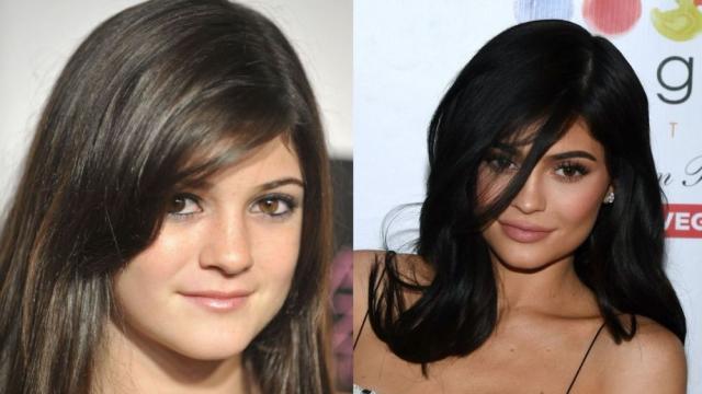 Корекциите на устни – враг или приятел на звездите (СНИМКИ)