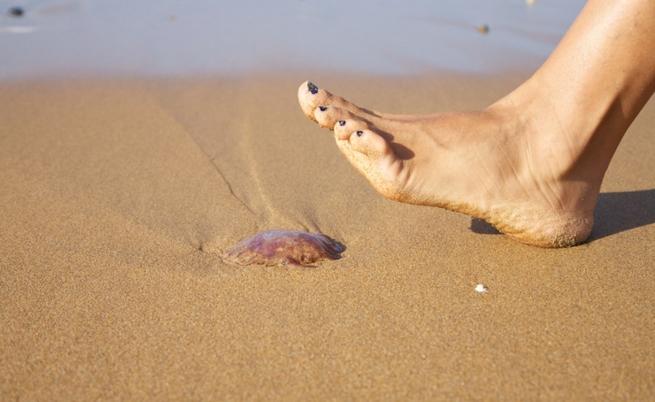 Опарването от медуза е неприятно. 