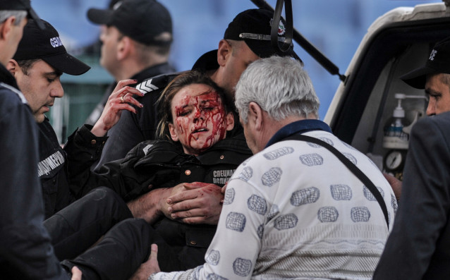 Полицайката която беше ранена от бомбичка в мача между ЦСКА