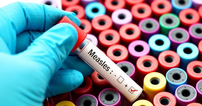 Рекорден брой заболели от дребна шарка (морбили) в Европа отчита