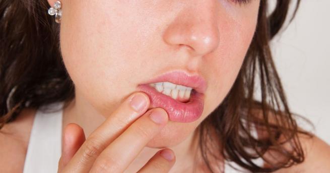 Устният херпес и най-често срещаната форма на вирусна инфекция. Сред