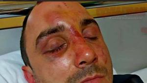 Пламен Николов пребит Айтос цигани