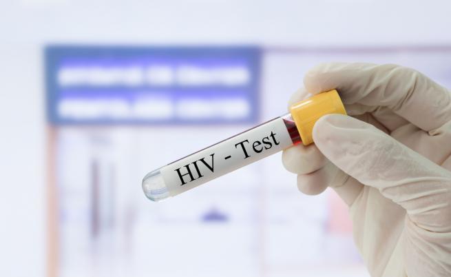  Испански учени отстраниха ХИВ от пациенти 