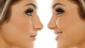 нос жена жени носове