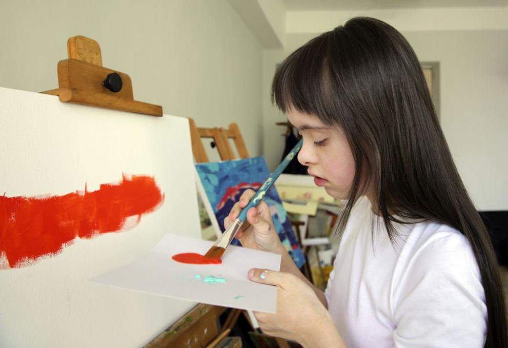  Синдром на Даун 