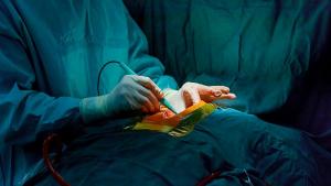 Лекари в болница в италианския град Торино извършиха двойна сърдечна