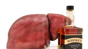 черен дроб алкохолизъм