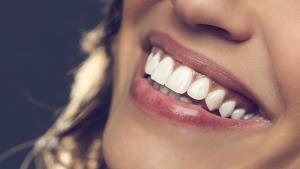Белите зъби са много важна част от външния вид  Всички си