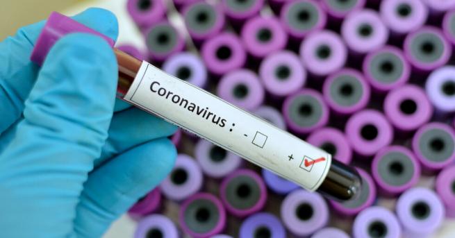 България Всички проби изследвани днес за коронавирус са отрицателни През