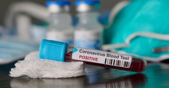 Коронавирусната епидемия в Иран е отнела 26 живота съобщи здравното