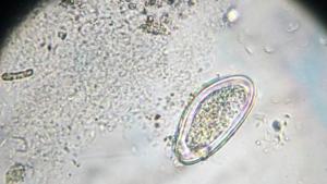 паразит микроскоп