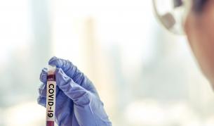 <p>ЕК подписа договор за 63 млн. евро за доставка на "Ремдесивир"</p>