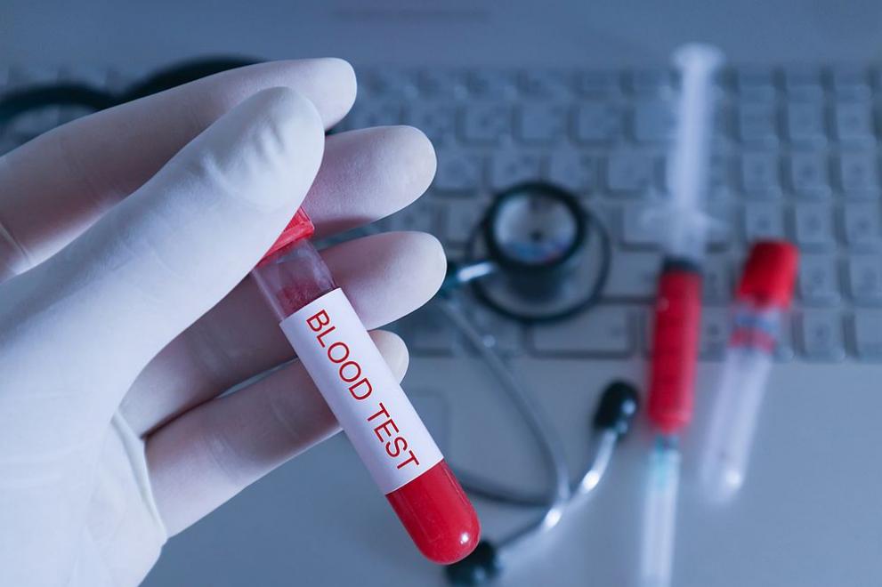  кръвен тест 