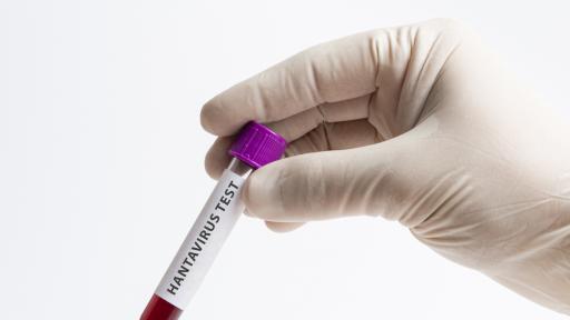  Човек умря от хантавирус в Китай, има ли причина за паника 