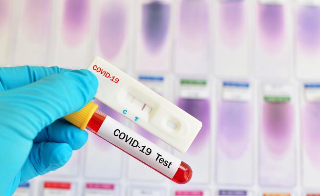 В Германия тестват ваксина срещу коронавируса