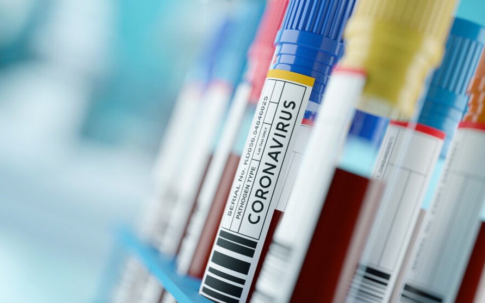 1300 са потвърдените случаи на COVID-19 у нас по данни