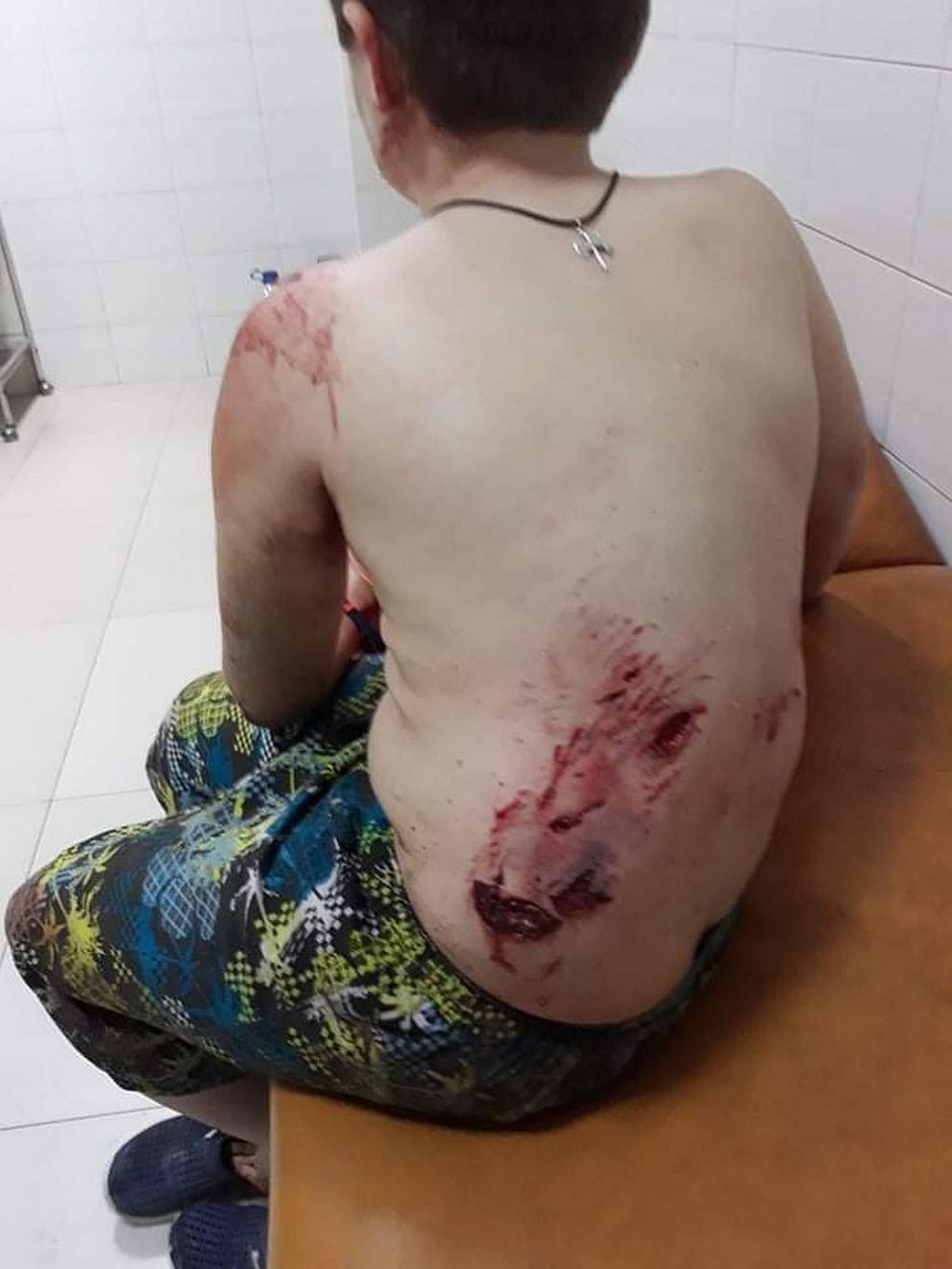  нахапано дете крън 