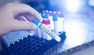 <p>Огнище на COVID-19 в Гърция, близо до България&nbsp;&nbsp;</p>