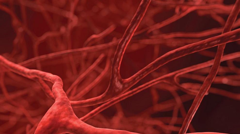 Как да почистим кръвоносните си съдове по естествен начин