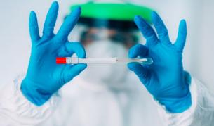 Предложение: Направление за PCR тест при 2 симптома