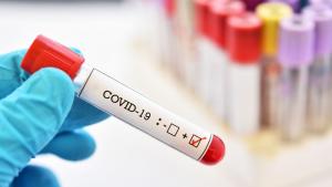 62 нови случая на коронавирус са били регистрирани през последното