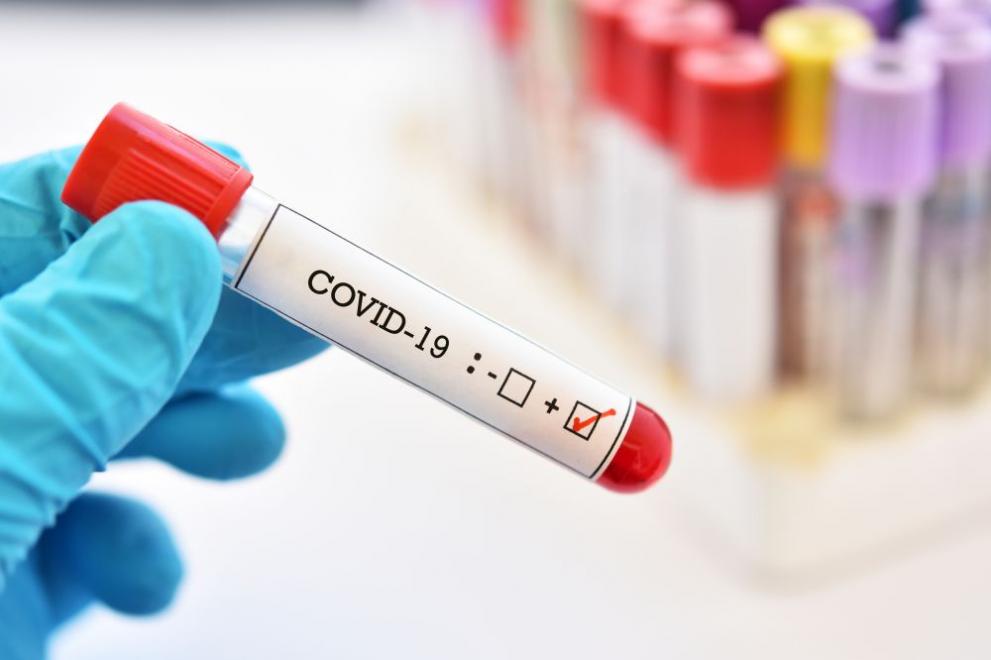 62 нови случая на коронавирус са били регистрирани през последното