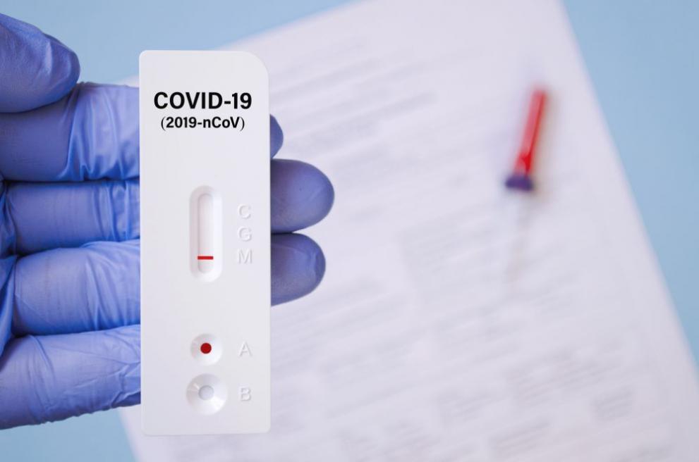 By order of Minister of Health Kostadin Angelov, rapid antigen tests are being added as a laboratory criterion in diagnosing COVID-19